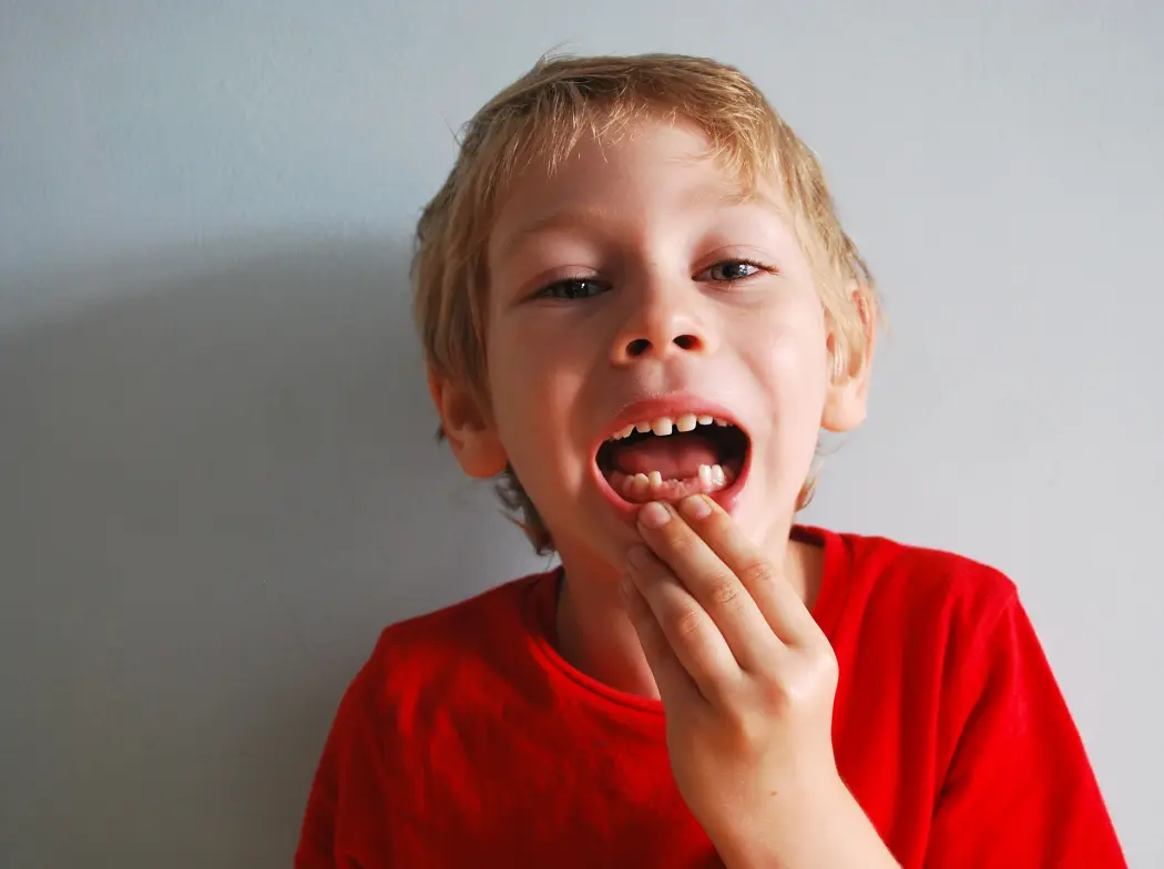 Wszystko, co musicie wiedzieć o wyrywaniu zębów mlecznych u dzieci